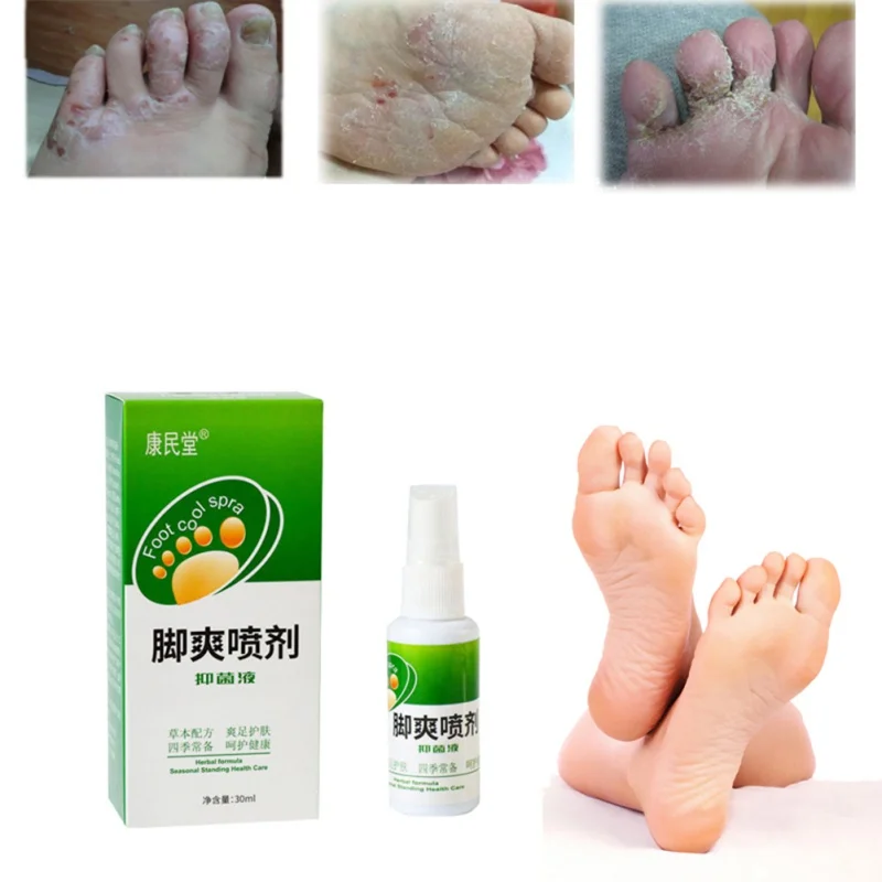 30ml Plant Spray Feet Care Remove Odor Sweat Feet Treatment Wholesale Natural Practical Foot Care Products