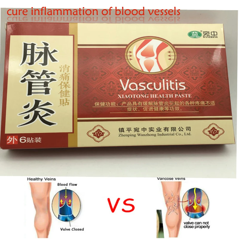 18pcs Hot Sale Varicose Veins Cure Patch Vasculitis Natural Solution