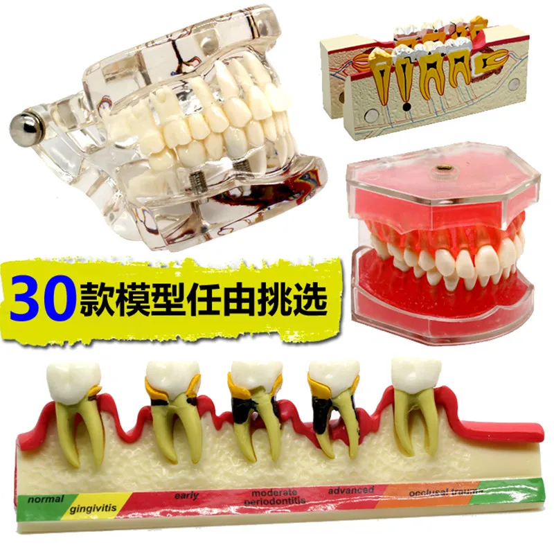 Usados para Ensino e Material de Hospital Material de Dentista Vários Modelos Dentes Dentários São 3 Vários modelos dentes dentários são usados para