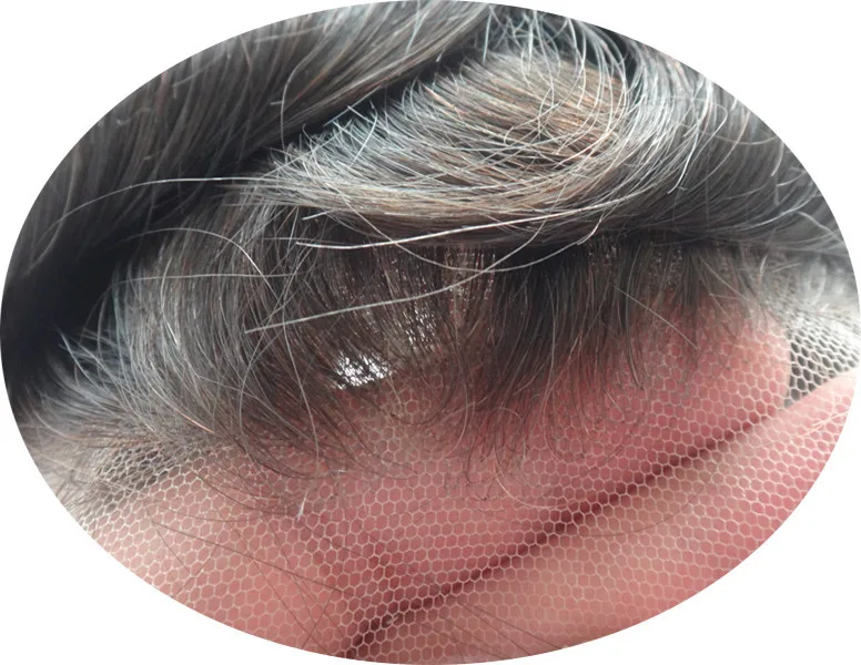front bleaching  color 1b 