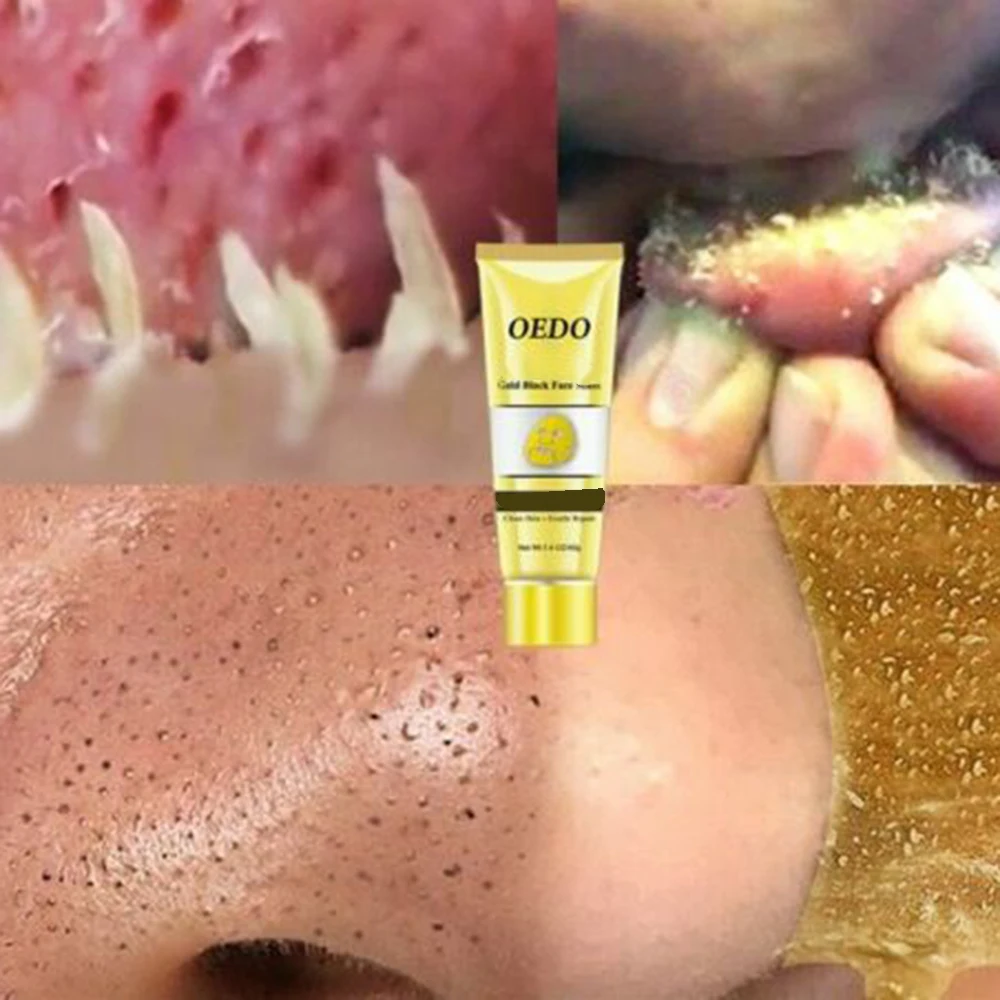 

Hot Sale Remove Blackhead Mask Shrink Pore Improve Rough Skin Acne Blackhead Remover Mask Facial Moisturizing Cream