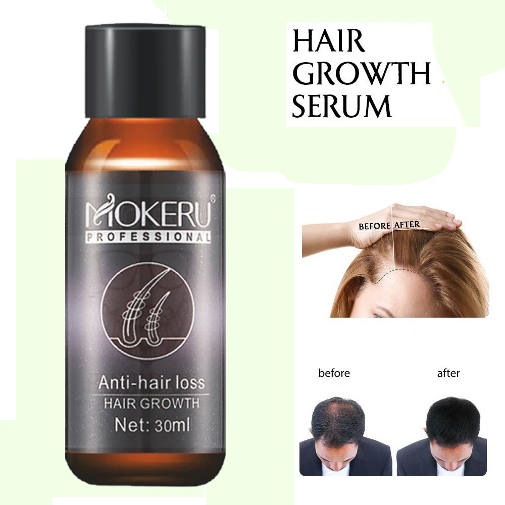 Mokeru 2pcs Lot Natural Herbal Essence Hair Loss Products Fast