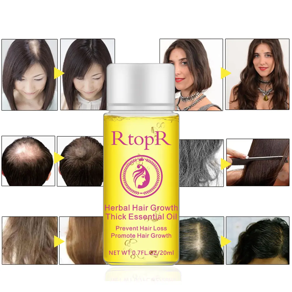 20Ml Hair Oil Fast Hair Growth Essence Human Baldness Natural Herbal Powerful Hair Growth Treatment Fluid Anti Hair Loss 20Ml Hair Oil Fast Hair Growth Essence Human Baldness Natural Herbal Powerful Hair Growth Treatment Fluid Anti Hair Loss