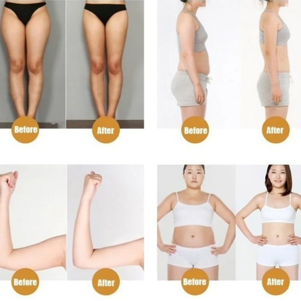 40Pcs Slimming Patch Natural Traditional Chinese Medicine Navel Slim Patch Weight Loss Cellulite Burning  Patch Diet DROPSHIP