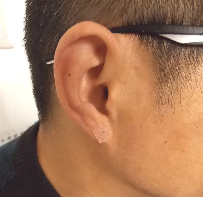 200pcs Pellets Ear Therapy Patch Beads Ear