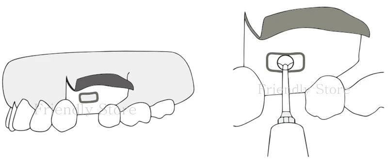 3_