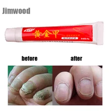 1 шт. грибок для ногтей, употребление онихомикоза, парониксия, анти грибковая инфекция ногтей, хороший результат, Китайский Травяной Уход за ногтями