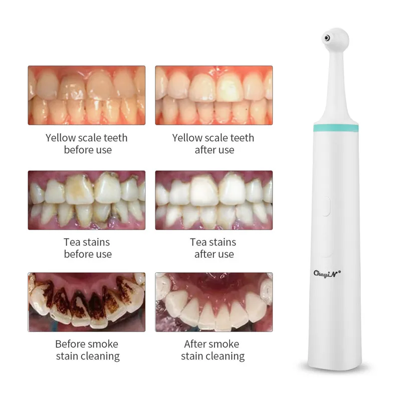 Goedkoop Multifunctionele Dental Elektrische Tand Polish Cleaner Professionele Stain Plaque Remover Sonic Trillingen Tanden Whitening Gum Hoofd
