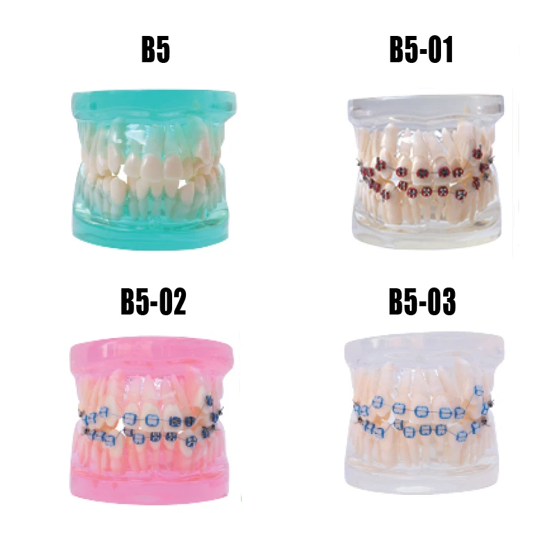 Стоматологическая модель зубов Ортодонтическая модель стоматологический манекен с металлом или керамический кронштейн