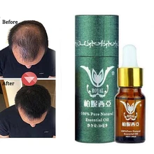 Продукты для роста волос натуральные без побочных эффектов более быстрое лечение роста волос Восстановление роста Pilatory продукты против выпадения волос