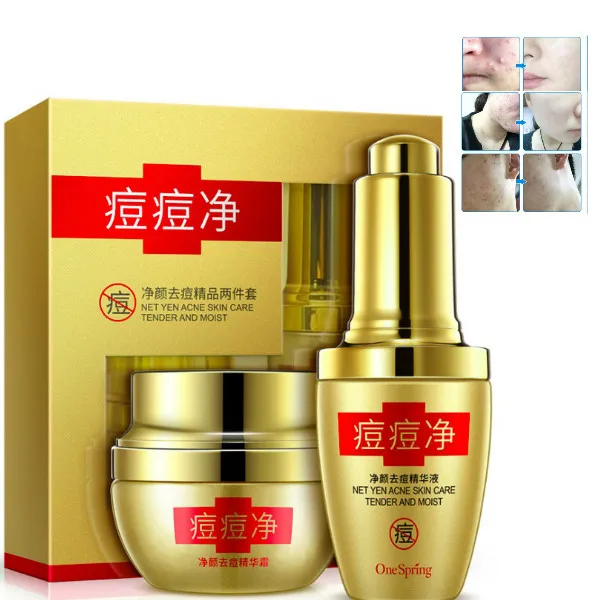 

serum+face cream cleansing acne scars treatment boutique skin care products nourish mild acne cosmetics black head remover
