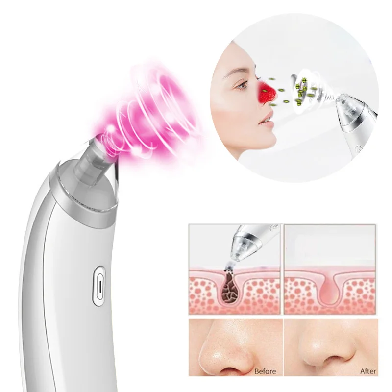 

ELECOOL Vacuum Blackhead Suction Cleaning Instrument Blackhead Remover Acne Pore Cleaner Deep Facial Cleaning Machine Household