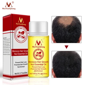 

1 PCS Hair Growth Essence Hair Loss Liquid Natural Pure Nut Essential Oils Promote Hair Growth Serum Health Care Beauty Essences