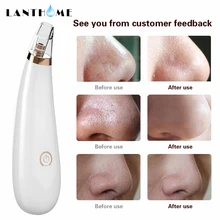 Очиститель пор акне черная точка прыщи для удаления черных точек электрический пылесос для удаления черных точек инструменты для ухода за кожей