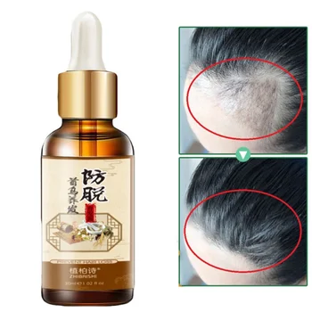 

30ml Hair Essence Hair care Oil Chinese Herbal Heshouwu Essence