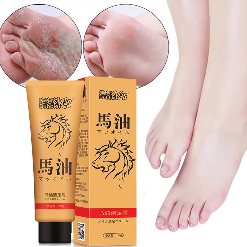 Cracked Heel Balm Cream For Foot Mask Feet Cream Dead Skin Removal Foot ...
