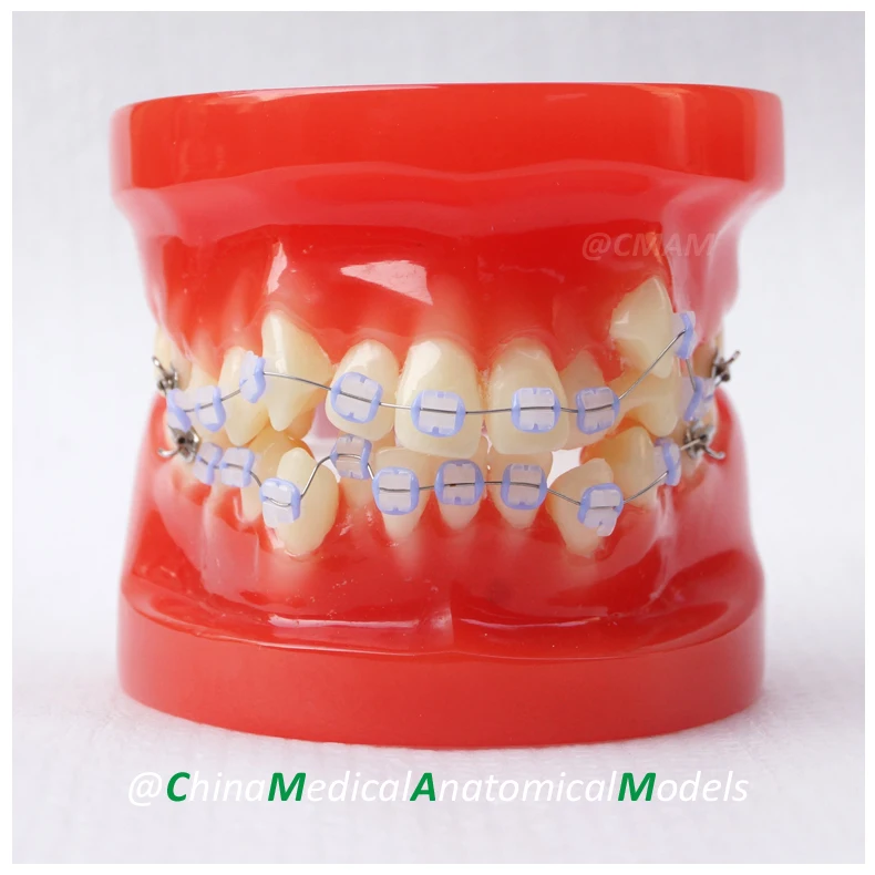 

No.13033, Ortho Ceramic Bracket Model, Dentist Training Oral Dental Ortho Ceramic Bracket Model, China Medical Anatomical Model