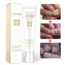 Лечение ногтей от грибка по уходу за ногами отбеливающая эссенция носком удаление ногтей гель анти-инфекция онихомикоз ногти ремонт сущность TSLM1