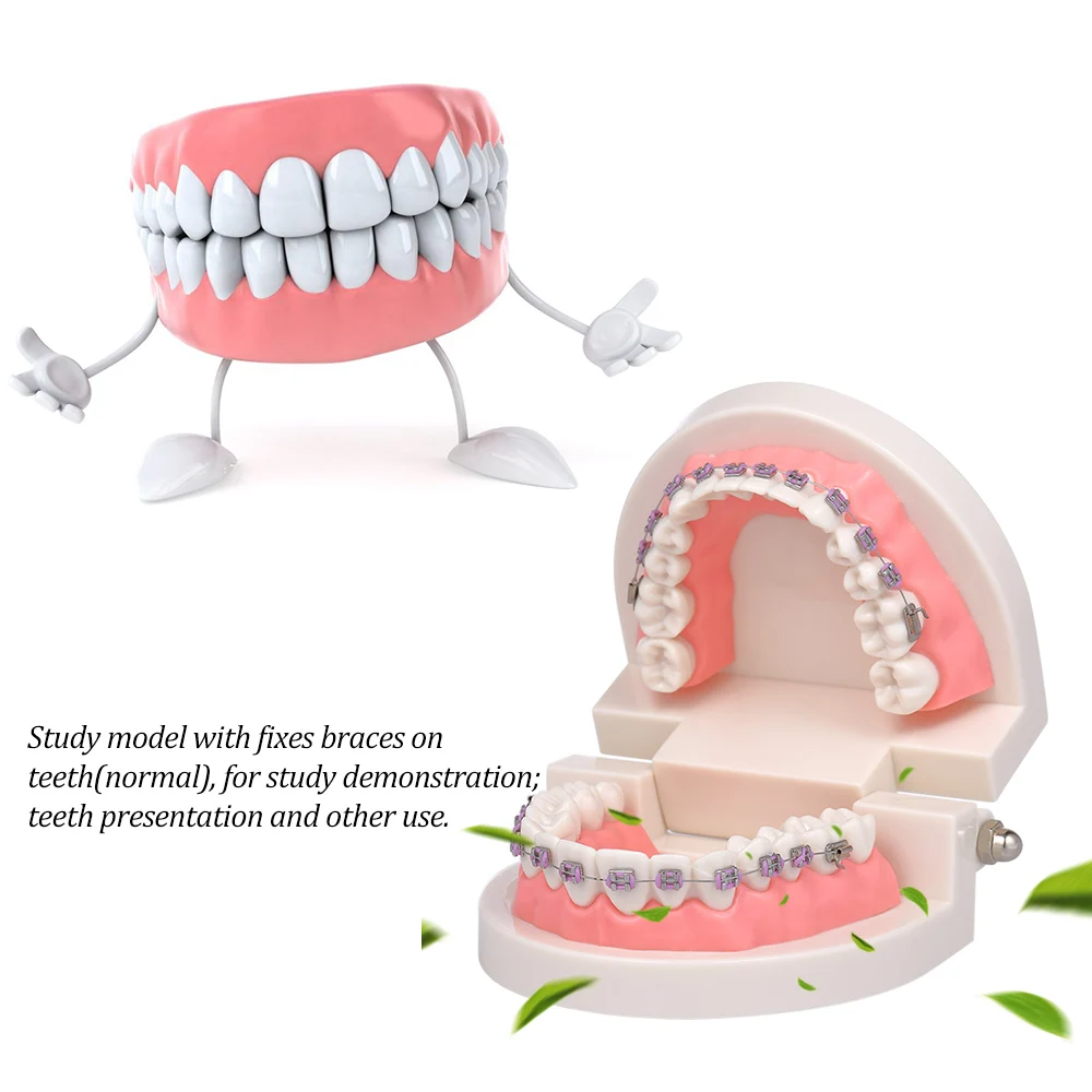 Щечной трубки Зубы Модель Стоматологическая Ортодонтического Mallocclusion модель с кронштейны дугу для пациента Связь взрослых преподавания