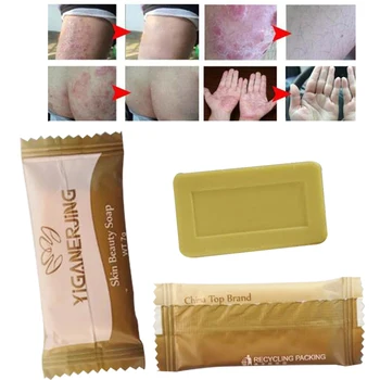 

Sulfur Soap add 1PC zudaifu Psoriasis Cream Dermatitis Eczematoid Eczema Ointment Treatment Skin Psoriasis D281