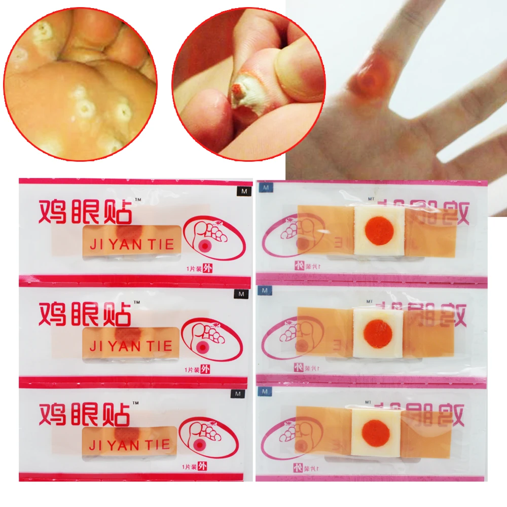 100 Pcs Lot Mengurangi Tekanan Kaki Stiker Perawatan Pereda Rasa 100 Pcs Lot Mengurangi Tekanan Kaki Stiker Perawatan Pereda Rasa