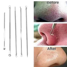 Набор для удаления угрей и акне, инструмент для удаления угрей, ложка для чистки лица