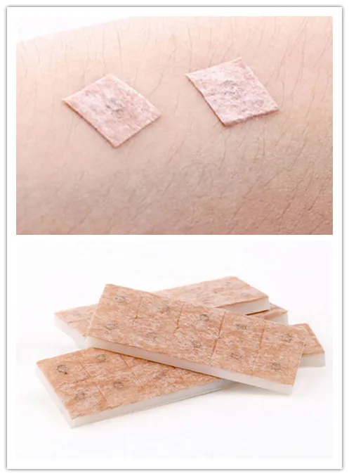 100Pcs/box Acupuncture Needles Disposable Acupuncture Press Needles Feminine Hygiene Product for Health Care Supplies