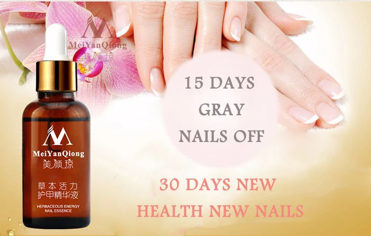 Fungal Nail Treatment Essence Nail and Foot Whitening Toe Nail Fungus Removal Feet Nail Care Essential oil
