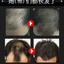 Распродажа запасов Сыворотка от выпадения волос Быстрый мощный средства для роста волос рост жидкий экстракт обработки предупреждающий потерю волос