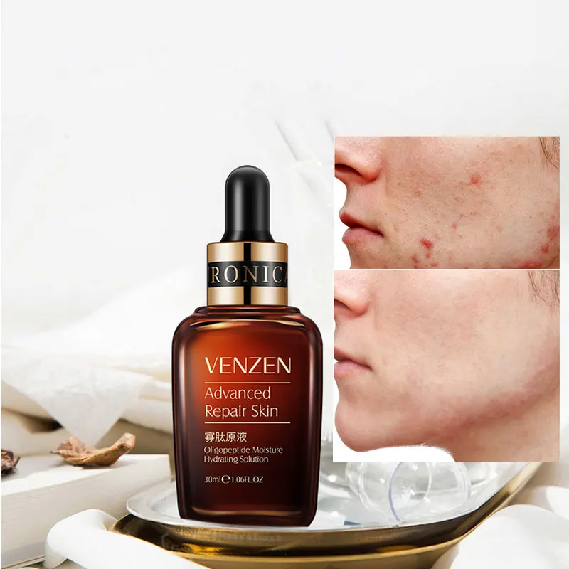 

VENZEN Hyaluronic Acid Anti Wrinkle Serum Face Care Essence Acne Treatment Hydrating Brighten Skin Moisturizing Whitening Cream