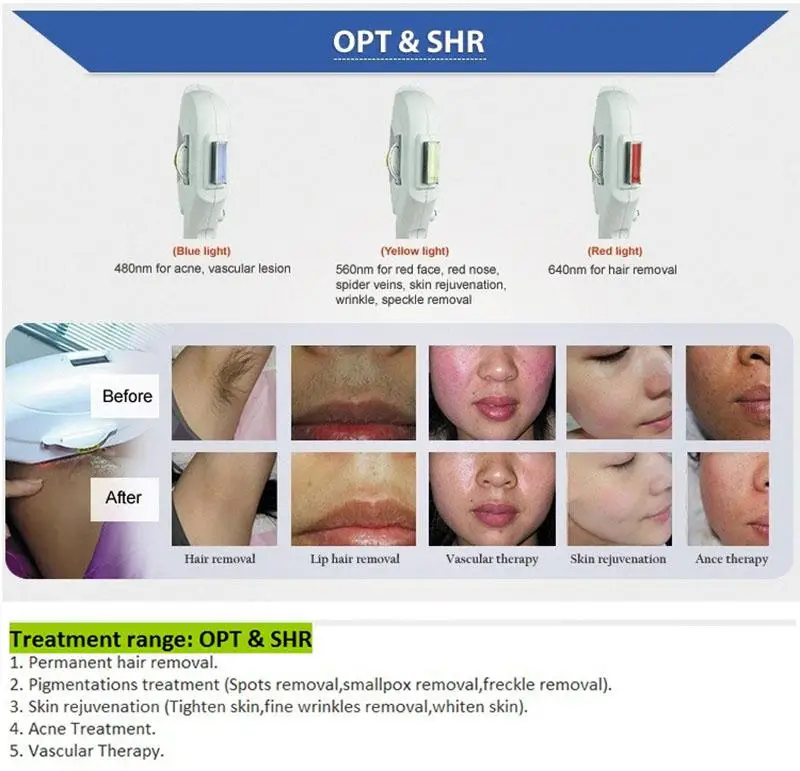 Elight IPL Удаление волос OPT SHR IPL машина для удаления волос