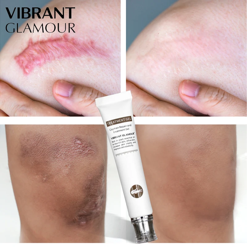 VIBRANT GLAMOUR Repair Scar Cream Set Crocodile Eye Cream Remove Dark Circle Whitening Remove Stretch Marks Skin Care Anti-Aging