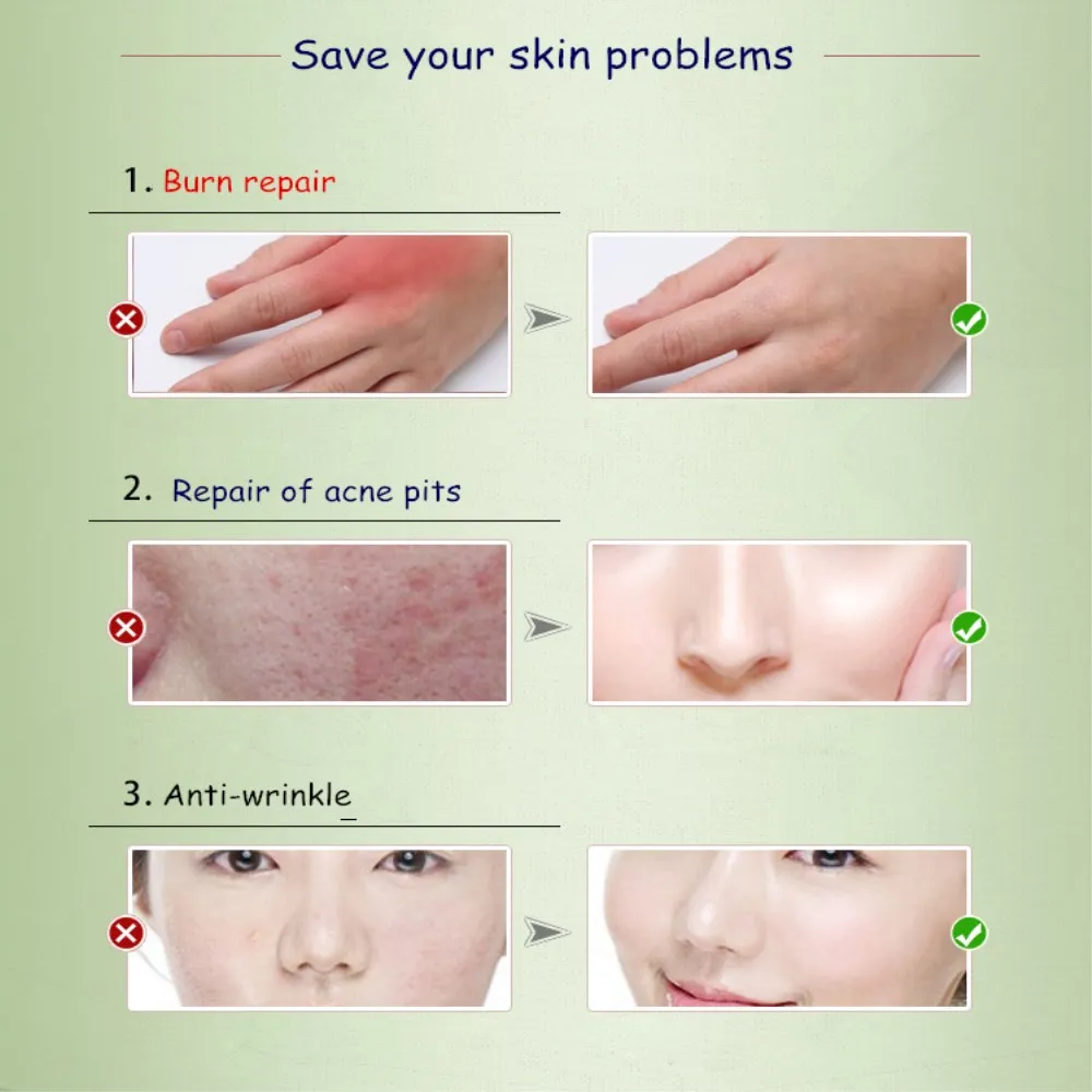 How to be remove fat photo 3