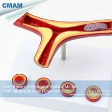 CMAM-HEART06 Oversized Human Artery Anatomy Model , Medical Science Educational Teaching Anatomical Models
