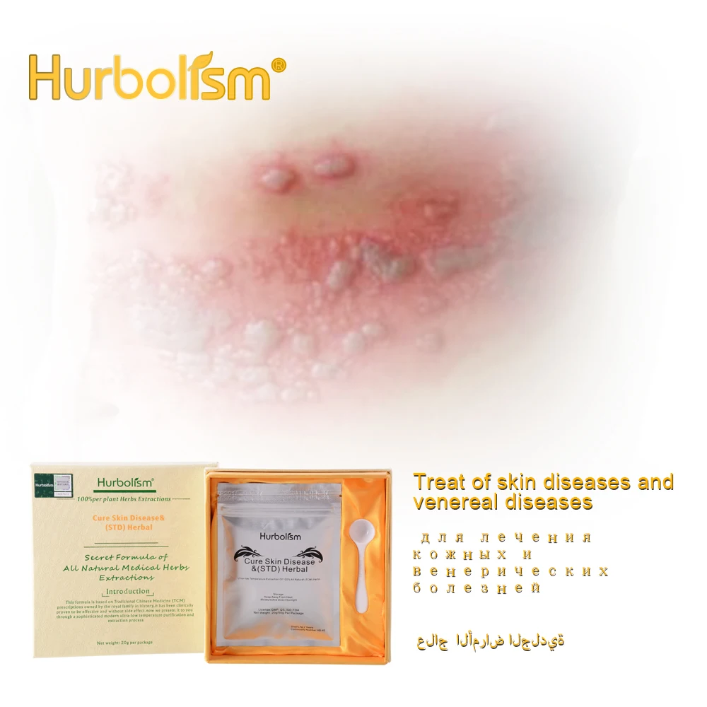 Травяной порошок Hurbolism TCM новый обновленный травяной для лечения ИППП и