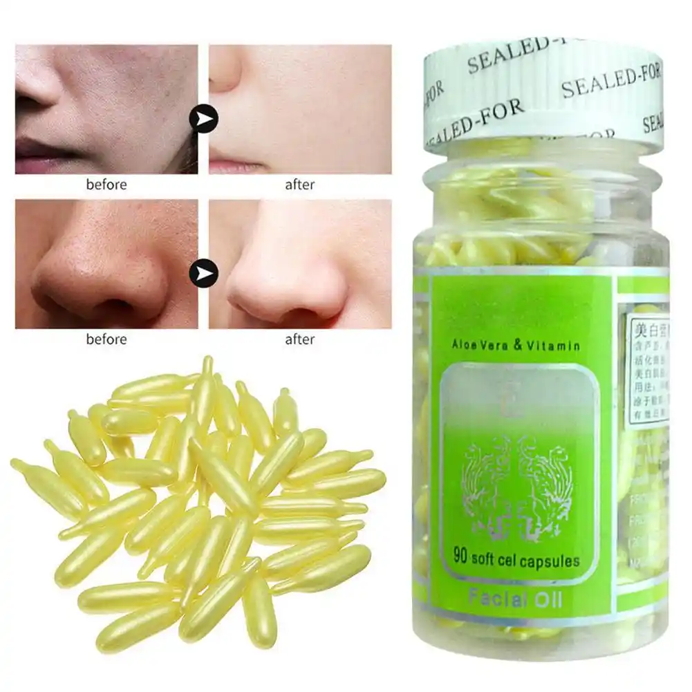 vitamin e capsule uses for acne
