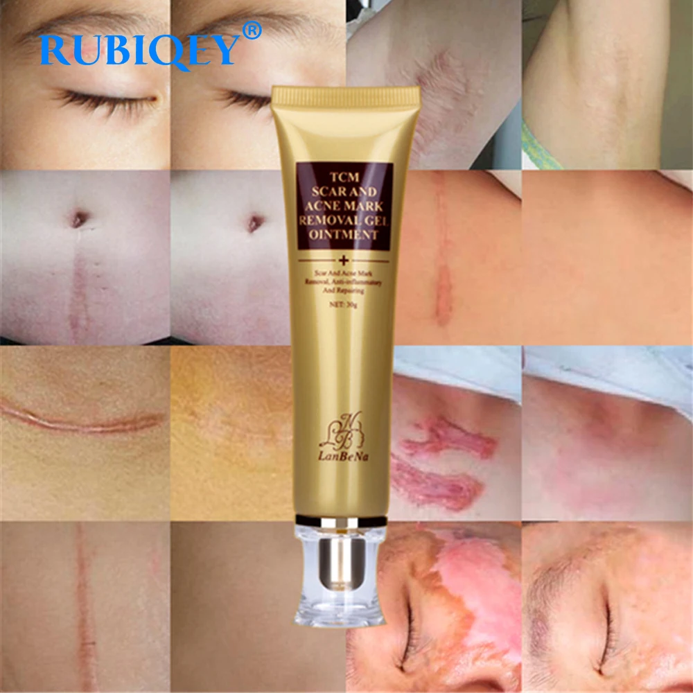 

LANBENA Scar Removal Cream Ginseng Extract Skin Care Repair Spots Acne Treatment Stretch Marks facial blackhead Bleaching Cream