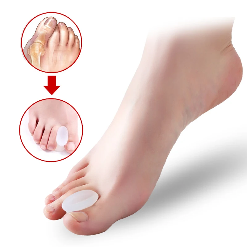 1Pair Bone Thumb Valgus Protector Silicone Foot Finger Toe Separator Bunion Adjuster Hallux Valgus Corrector Pedicure Feet Care