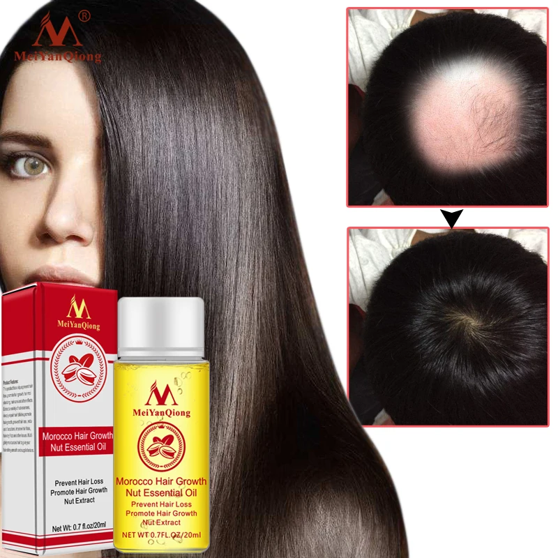 20 мл естественное постоянное увеличение защищает поврежденные волосы для Сушеные Орехи Уход за волосами аромат роста волос эфирное масло