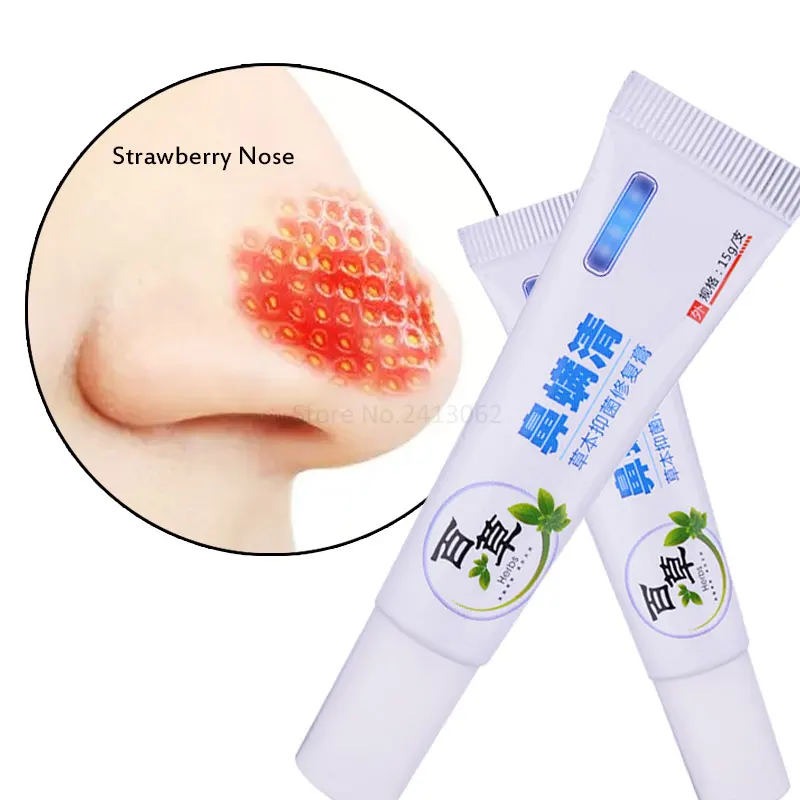 

Rosacea Treatment Gel Nose Redness Removal Cleaning Antibacterial Gel Strawberry Nose Skin Care Nose Cleaning Cream Red Nose Gel