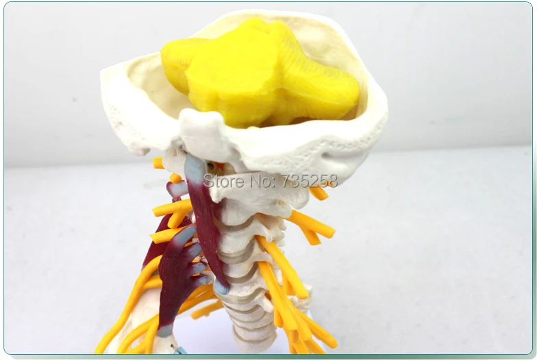 После шейного позвонка, сонной артерии, затылочной, межпозвонкового диска и модели нерва, Шейная модель позвонка