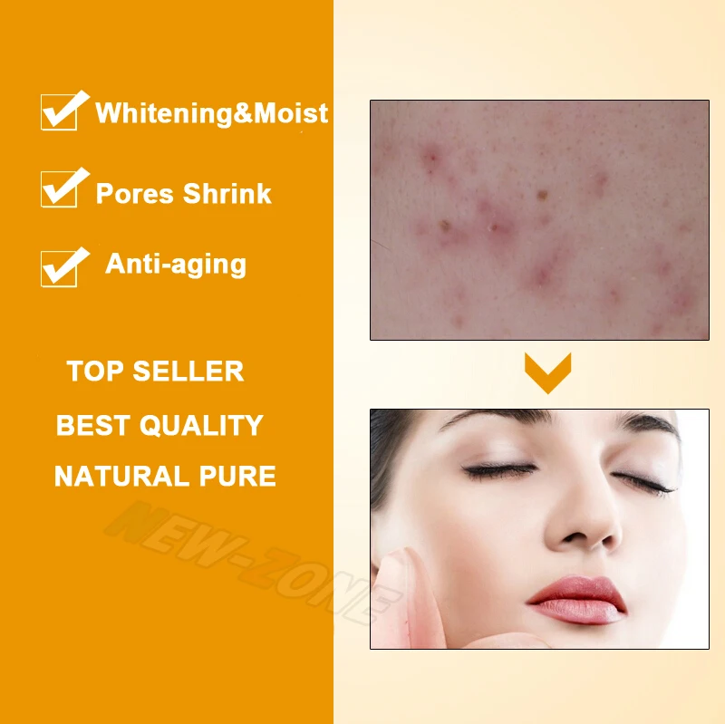 best collagen for acne scars