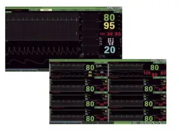 

CONTEC CMS9000 Central Monitoring System,Networked to CONTEC Patient Monitor