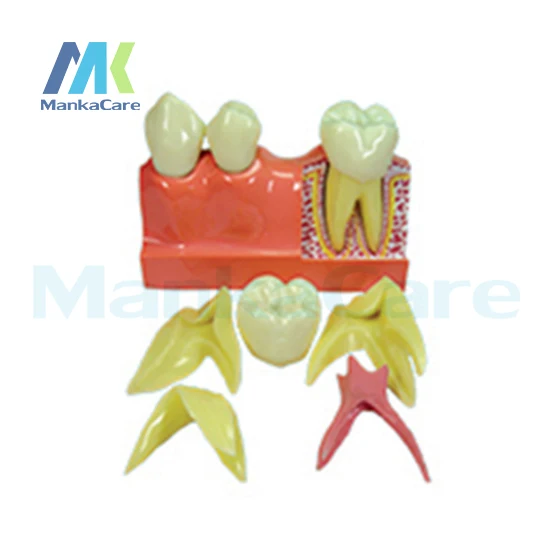 Manka Care - 4Times Disassembling/Imported resin teeth/Imported quartz rubber plate Oral Model Teeth Tooth Model