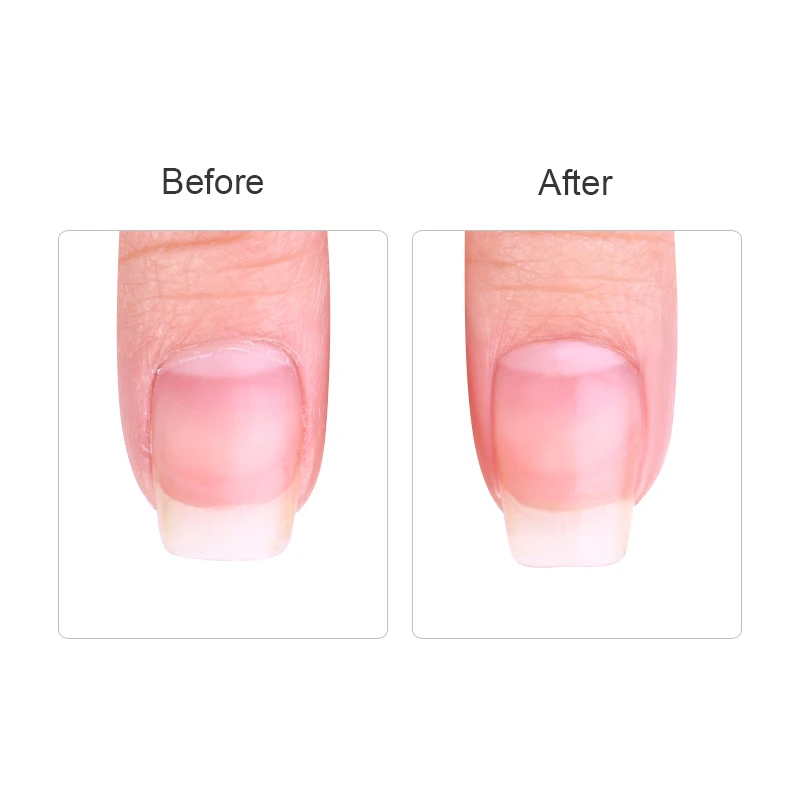 1 Pc BORN PRETTY 2ml Cuticle Softener Pen Dead Skin Remover Treatment Manicure Nail Care Exfoliator Oil Nail Art Tool