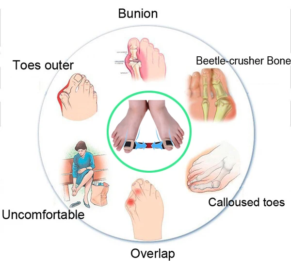 massage Hallux Valgus Orthotics BigToe Stretcher Corrector massage Bone Thumb Training Corretivo massage Splint CorrectionZ31501