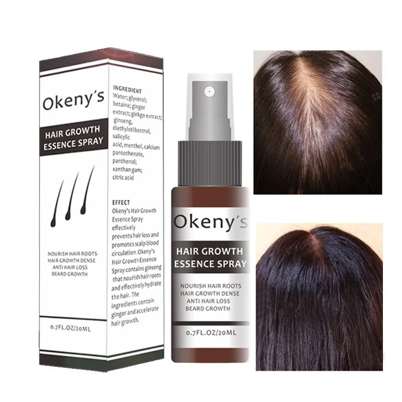 Okeny's Hair Essence спрей масло для роста предотвращающее облысение против выпадения волос уход за волосами питательное увеличение корней волос