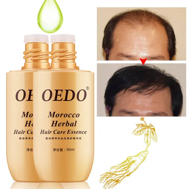 

Herbal Ginseng Hair Care Essence Treatment For Men And Women Hair Loss Fast Powerful Hair Growth Serum Repair Hair root