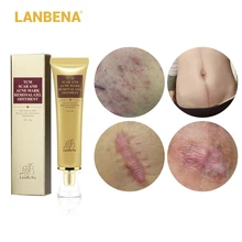 LANBENA 30ml Acne Scar Stretch Marks Remover Cream Skin Repair Face Cream Acne Spots Acne Treatment Blackhead Whitening Cream LANBENA 30ml Acne Scar Stretch Marks Remover Cream Skin Repair Face Cream Acne Spots Acne Treatment Blackhead Whitening Cream