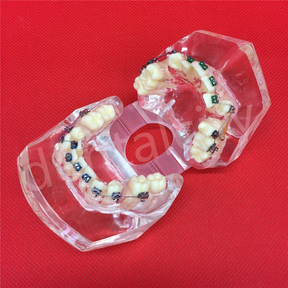 Стоматологические модели зубов используются для обучения и больницы стоматолога материал Malocclusion Ортодонтическая модель